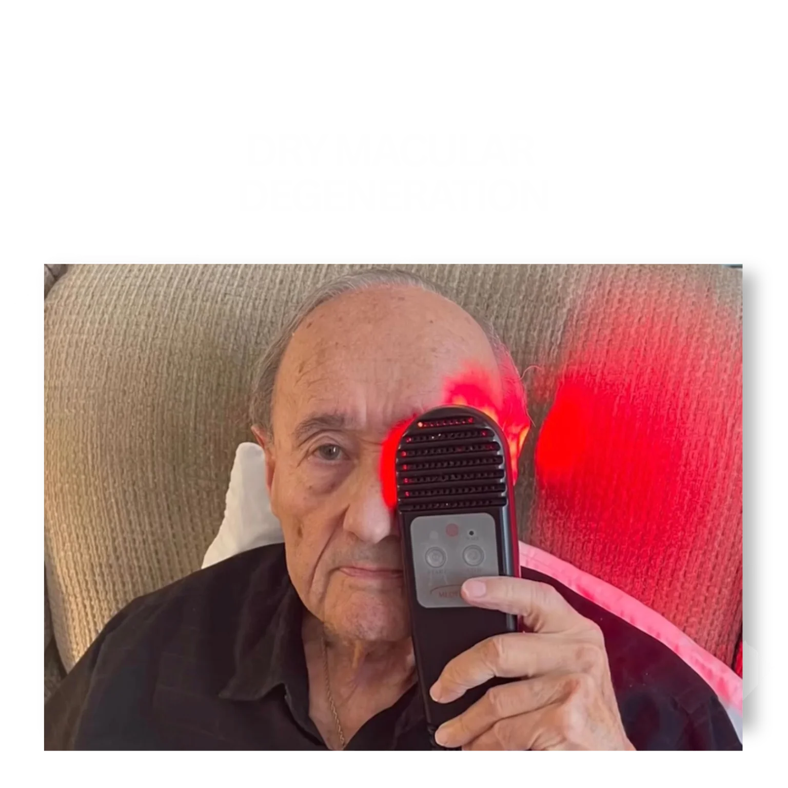 Dry Macular Degeneration (1)